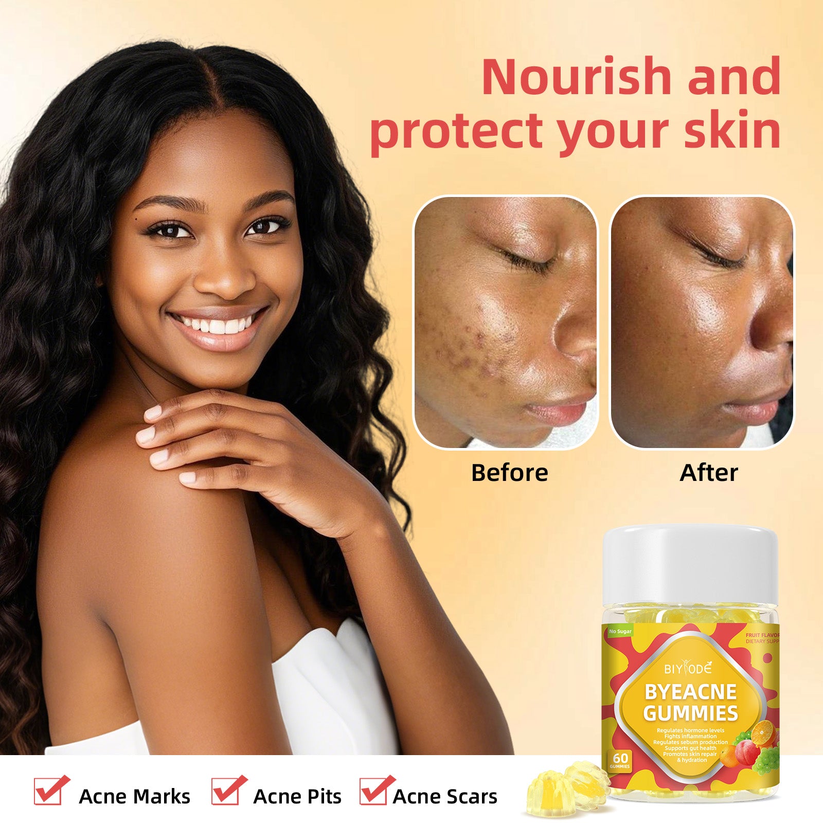 Custom Private Label ByeAcne Gummies -Hormone Balance Reduce Acne &Supports Gut Health No Sugar GMP Certified