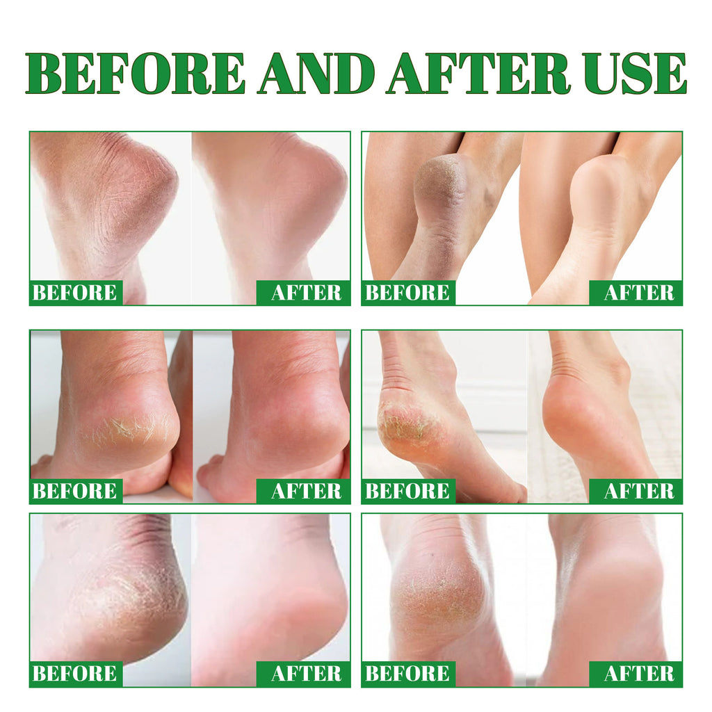 Moisturizing Foot Cream - SoftStep
