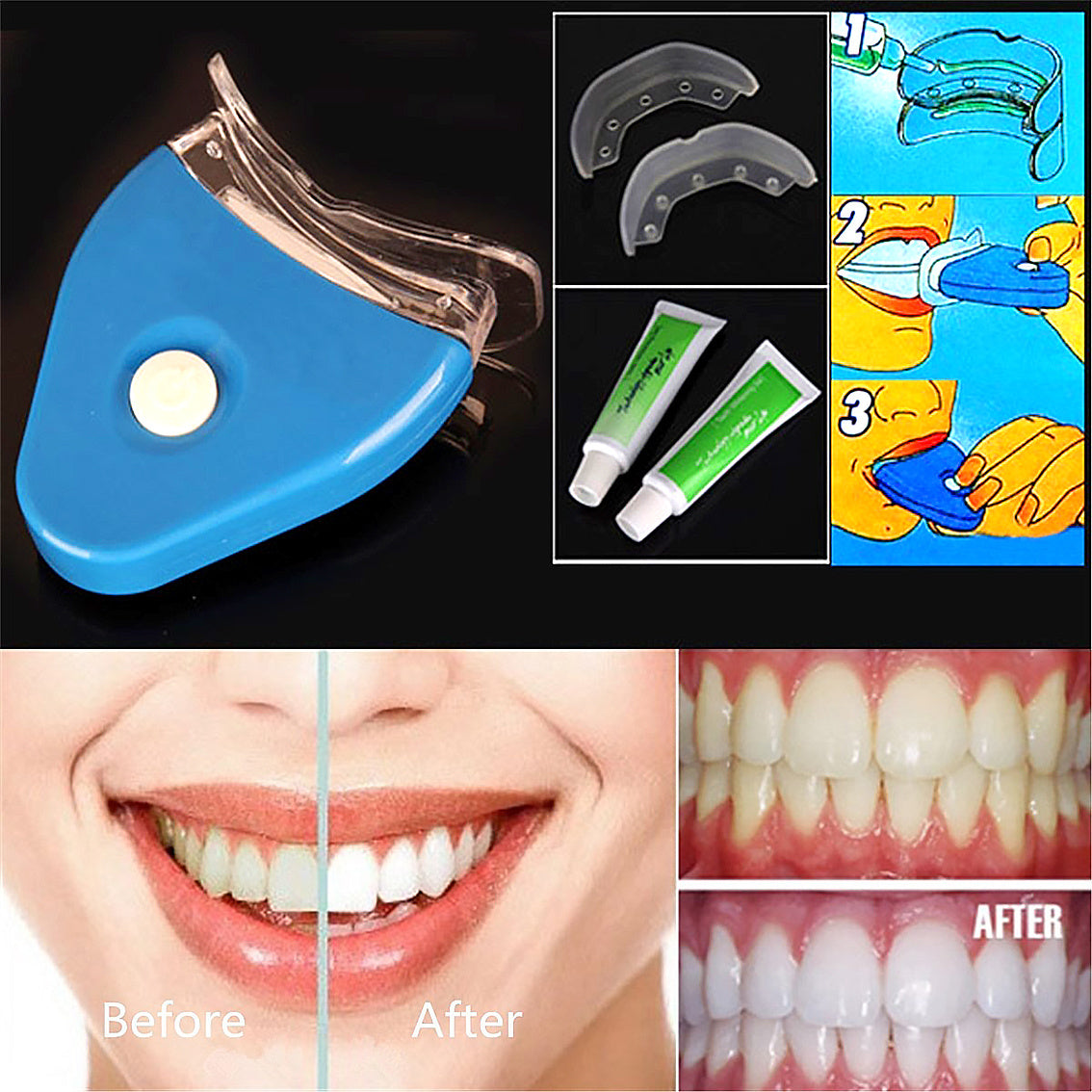 Tooth whitening Kit-PureSmile